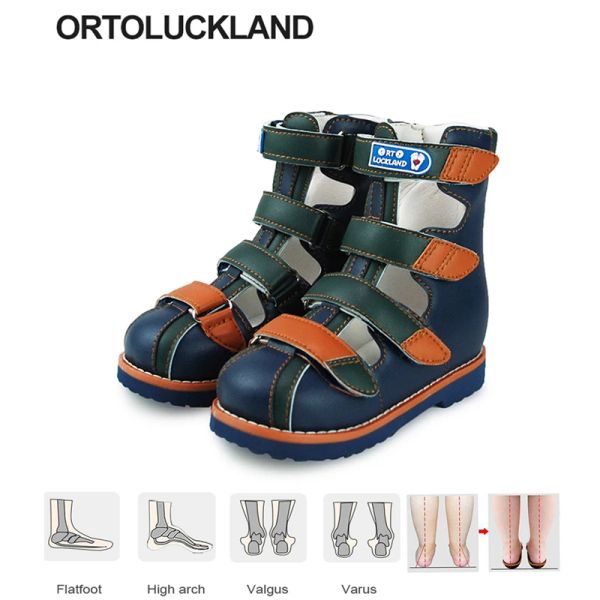 Outdoor Baby Mädchen Sandalen Sommer Orthopädische Schuhe Für Kinder High Top Jungen Tipsie Klumpfuß Geschlossene Zehen Leder Schuhe Mit Orthesen Sohle