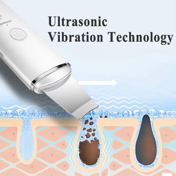 Dispositivos Ultrasonic Purificador de Pele Profunda Limpeza Ion Peeling Pá Facial Pore Cleaner Acne Blackhead Removedor Face Lifting Massager