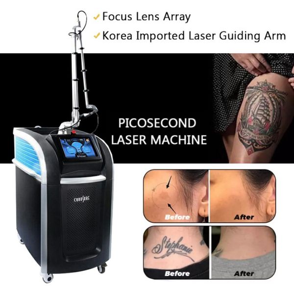 Laser Maschine Sommersprossen Tattoo Entfernung Pikosekunden Pico Laser Maulwurf Narbe Dunkle Flecken Entfernung Akne Haut Pigment Entferner Gesichts Machine420