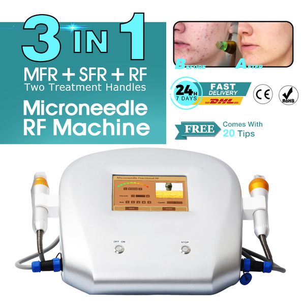 2023 Remoção de estrias Microagulha disponível Microagulhamento Fracionário RF Máquina Redução de rugas Tratamento de acne Dispositivo portátil de uso doméstico Dispositivo de microagulha