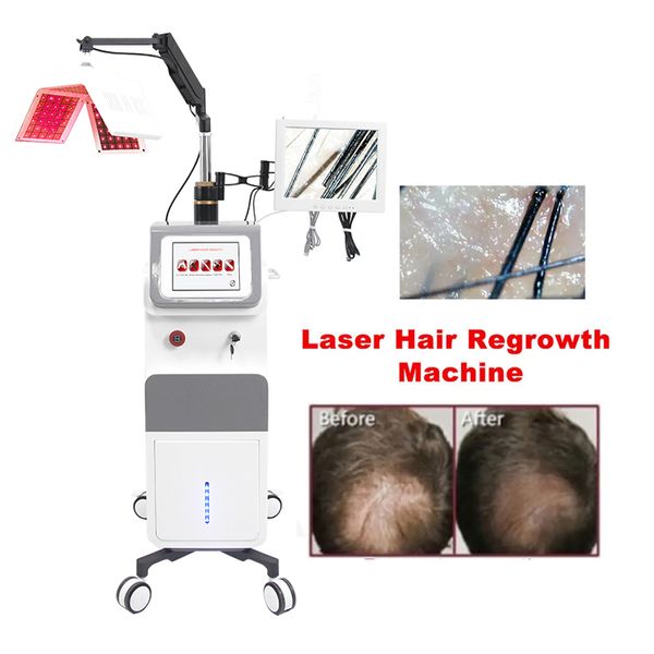 Другая красота 650 нм Диодный лазер для роста волос PDT Светодиодная расческа с анализатором волос Восстановление лечения отрастания Массаж головы Уход за машиной