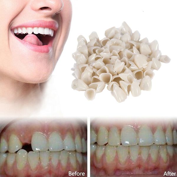 Altre corone temporanee di igiene orale posteriori anteriori molari denti bocconcini dentali Falso copertura denti rimovibili intacciatura 230921