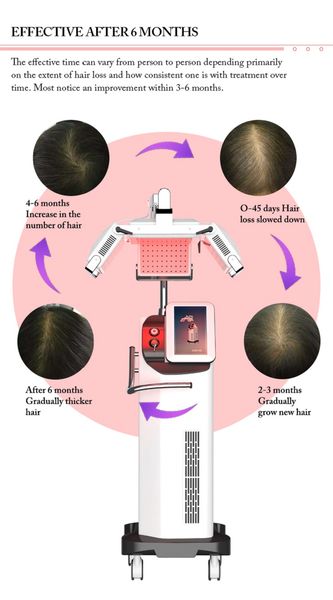 A mais nova máquina de crescimento de cabelo a laser de diodo, tratamento anti-perda de cabelo 650nm PDT, máquina de rebrota de cabelo, máquina de beleza a laser, análise de cabelo, uso de spa