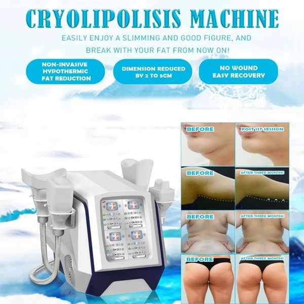 4 Silikongriffe, 4 Bedienelemente, 360-Grad-Kryotherapie-Schlankheitsmaschine, Cool Tech Sculpting Body Shape Fat Freezing Criolipolysis Fat Loss Machine zu verkaufen