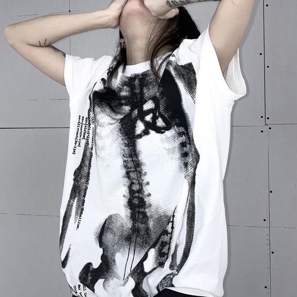Gothic X Rays T Shirts Mode Skeleton Punk Rock Kurzarm Sommer Lose Top Harajuku Ästhetischen Streetwear T Weibliche 230301