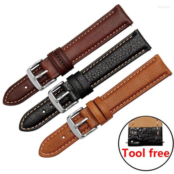 Assistir bandas Bandas de relógio de couro genuíno 18mm 20mm Lichee Pattern Strap Strap Stap Fit Withings Activite/ Aço// HR