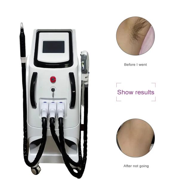 Articoli di bellezza 4 in 1 multifunzione OPT Laser Hair Removal Tattoo Removal Picosecond RF face lift Beauty Machine
