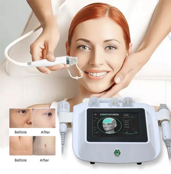 Articoli di bellezza RF frazionata Microneedling Machine Microneedle Cura della pelle Serraggio Cicatrice antirughe Terapia a radiofrequenza Apparecchiature RF