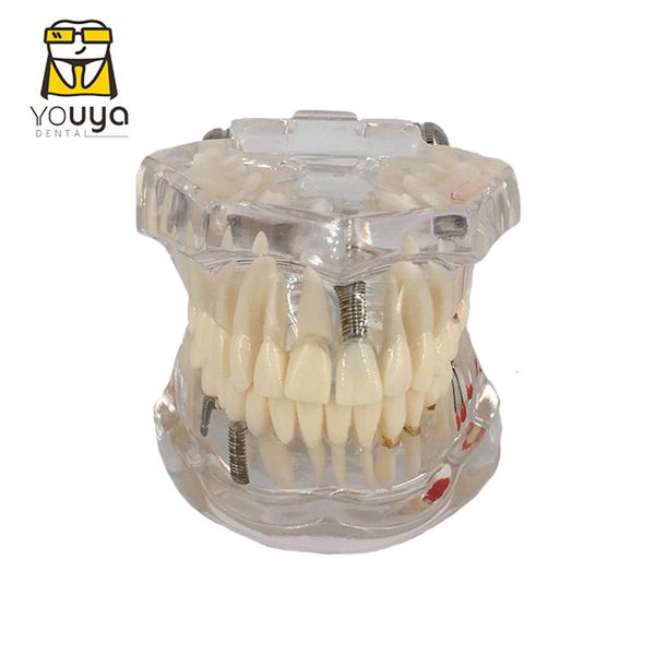 Altro Igiene orale Trasparente Malattia Modello dei denti Impianto dentale Modello dei denti Dentista Studente dentale Apprendimento Insegnamento Ricerca Comunicazione 230508