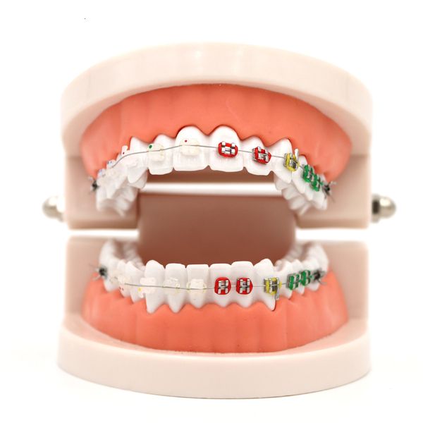 Altro Igiene orale 1pc Modello di trattamento ortodontico dentale Con staffa in metallo orto in ceramica Arch Wire Tubo buccale Legature Legature Strumenti dentali 230524