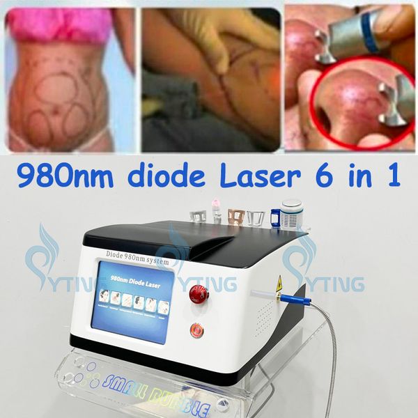 6-in-1-Laser, 980 nm, Diode, Gefäßvenenentfernung, Physiotherapie, Schmerzlinderung, Nagelpilzentfernung, Hautverjüngung, Ekzem, Herpes, Lipolyse-Maschine
