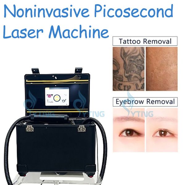 Laser Picoseond Macchina per la rimozione del tatuaggio del sopracciglio Q Switch Laser Non invasivo Pico Seconda pigmentazione del trattamento delle lentiggini