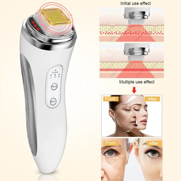 Dispositivo de levantamento facial de radiofrequência RF, matriz de pontos, massageador de beleza, removedor de rugas, máquina de massagem para aperto da pele 231220