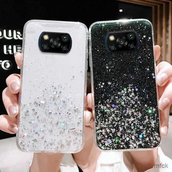 Casos de telefone celular para nota 9 pro caso glitter caso de telefone nota 11 10 pro 8 7 10s 9s mi 11 lite poco x3 pro capa