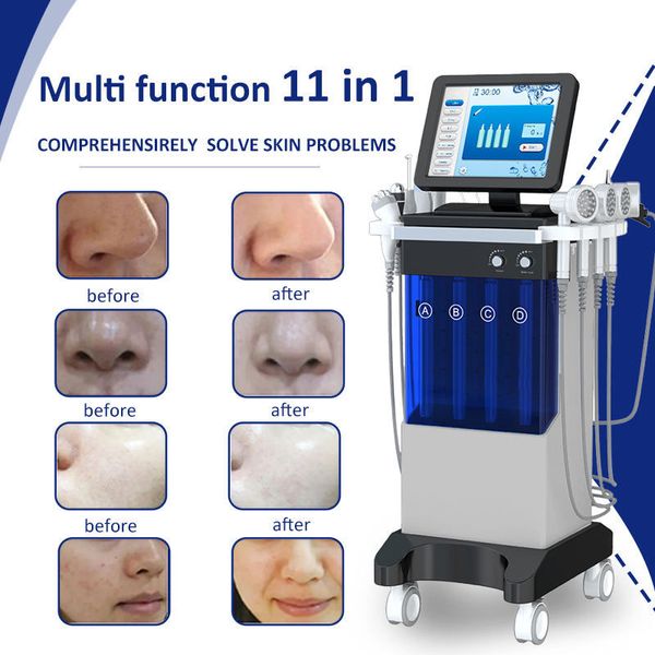 Jato de oxigênio 11 em 1 máquina hidro dermoabrasão facial dermapen máquina hidro facial