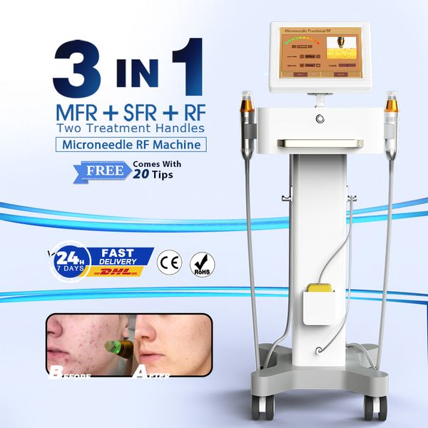 Videoschulung RF-Hautstraffungsmaschine, Mikronadelung, RF-Maschine, Entfernung von Aknenarben, 2 Griffe, Faltenentfernung, fraktionierte RF-Mikronadel für den Arm, CE-geprüft