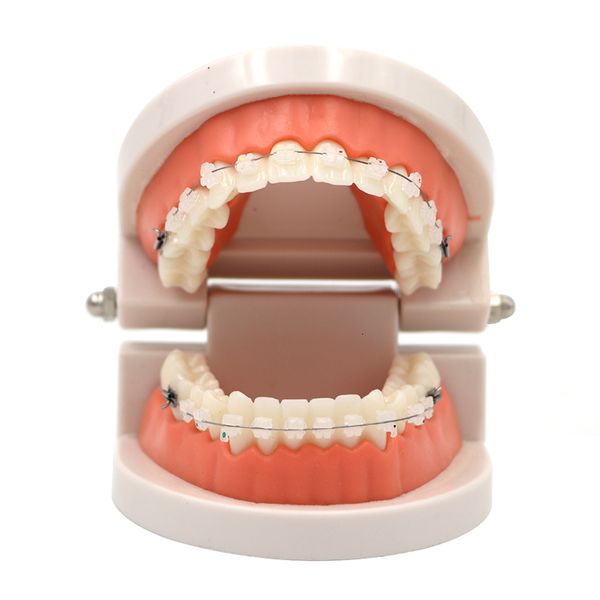 Altro modello di trattamento ortodontico dentale per l'igiene orale con staffa orto in metallo ceramica filo ad arco tubo buccale legature legature strumenti dentali laboratorio dentista 230719