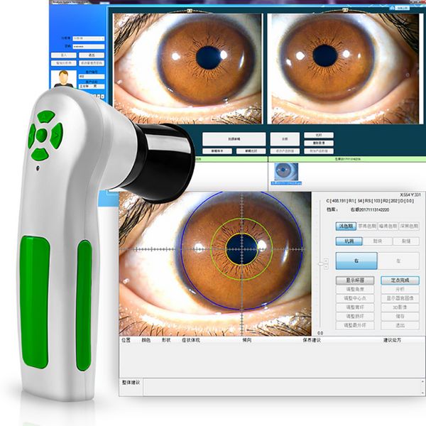 Modello di macchina dimagrante Digital Iriscope Iridology Camera Eye Test Machine 10.0Mp Iris Analyzer Scanner Ce DHL