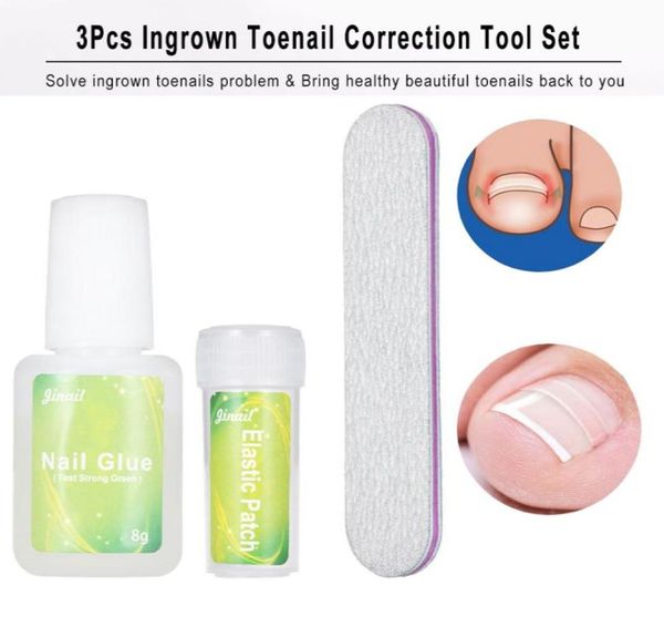 3 pçs ferramentas de correção de pedicure de unha encravada clipe de alisamento remendo de unha arquivo cola toe care tools5846534