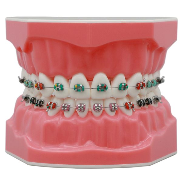 Dental Diş ipi Tipodont Ortodontik Diş Model 1 1 Standart Demo Archwire Ligature ile Öğretme Çalışması Metal Braketler Bukcal Tüpler 230421