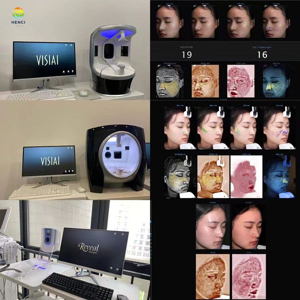 Hautdiagnosesystem 3D-Funktion VISIA Gesichtshautanalysegerät, intelligentes Gerät mit hoher Kostenleistung