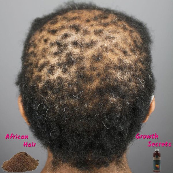 Shampoocondizionatore 100% Capelli naturali Prodotti di ricrescita per la crescita dei capelli estremi fermare l'alopecia e il diradamento dei capelli con questo potente trattamento