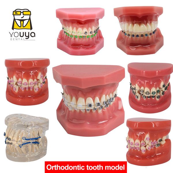 Outro modelo dental de higiene oral com aparelhos dentários materiais modelos ortodônticos goma dente modelo de dentes para estudar ensino educação do paciente 230609