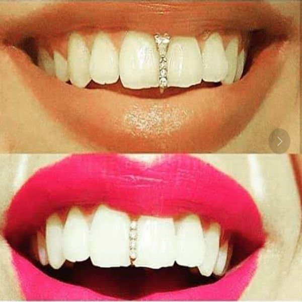 Hip Hop Rapper Dental Denti Grillz Oro Argento bretelle trapano completo Zircon shinny stick dente singolo denti griglie 1317