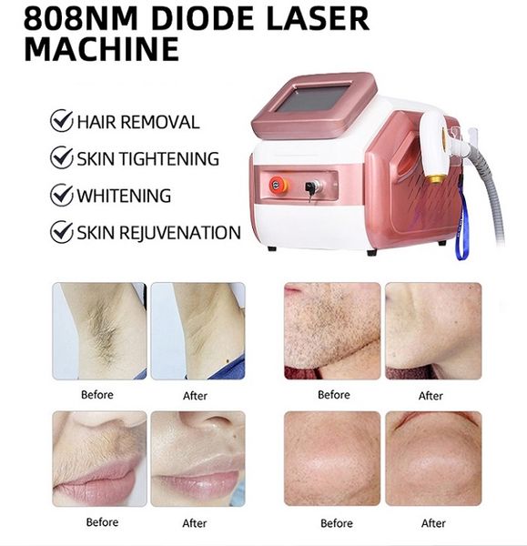 Macchina per la depilazione laser a diodi 808nm 3 lunghezze d'onda Laser a diodi Lazer 808nm Veloce Tutti i colori della pelle Epilatore laser Rimozione dei peli del corpo del viso