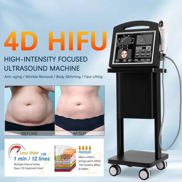 4D Hifu Gerichte Echografie Hifu Machine Slanke Apparaat Voor Face Lift Lichaam Afslanken Rimpel Verwijdering voor beauty spa