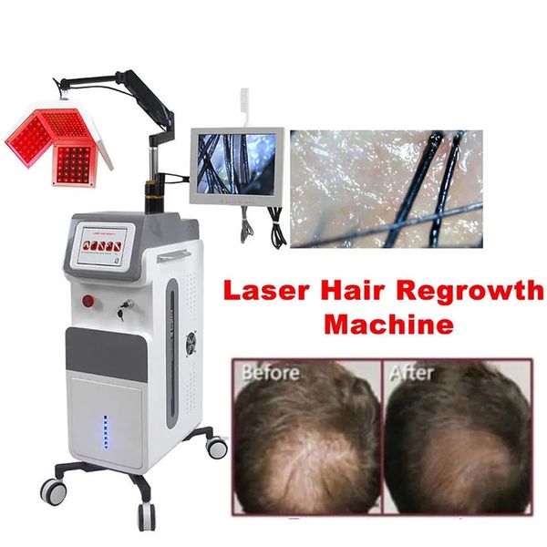 Vendite calde LED Laser a luce rossa 650nm Ricrescita dei capelli Macchina laser per la crescita dei capelli con analizzatore dei capelli Riparazione a crescita più rapida Alberi di capelli danneggiati Rafforza l'elasticità dei capelli