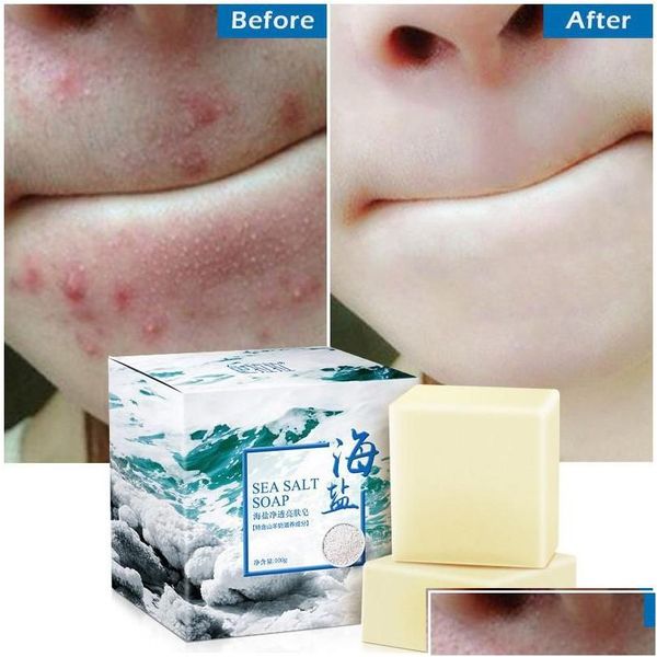 Sabão artesanal 100g remoção espinha poros acne tratamento mar sal sabão limpador leite de cabra hidratante cuidados faciais base de lavagem para gota de pele dhehq