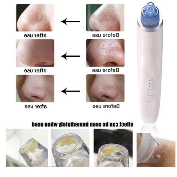 Aspirapolvere portatile Pulizia punti neri Acne Muco Espettorato Ricarica USB Dermica Crema idratante viso Strumenti Maschera nera Tessx