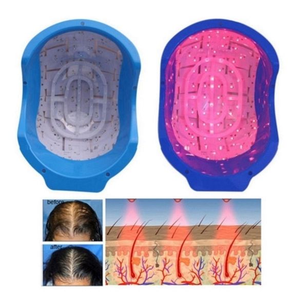 Capacete de crescimento de cabelo elétrico recarregável 678nm terapia a laser anti -perda de cabelo Máquina de tratamento Máquina de regenharia de massageador tampa