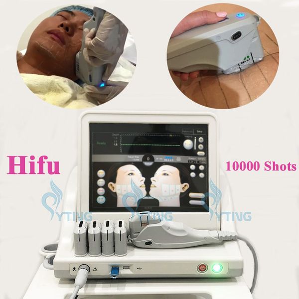 Hifu Ultrasound Machine Беспорядка