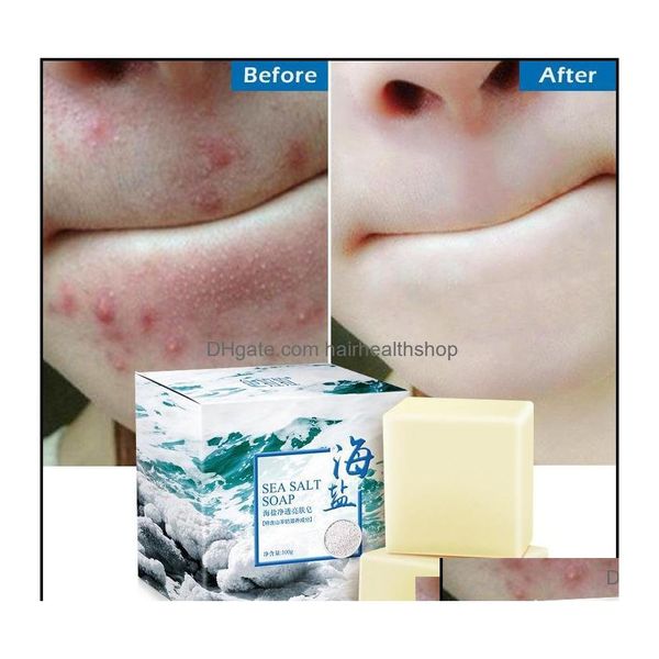 Sabonete artesanal sabonete artesanal banho corpo saúde beleza 100g remoção espinha poros tratamento acne mar sal limpador leite de cabra hidratante otv6m