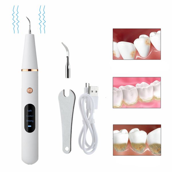 Outros dentes ultrassônicos de higiene oral Ferramentas de limpeza do sônico dental Sonic Sonic Stains Remoção de raspador de tártaro Irrigador 221121