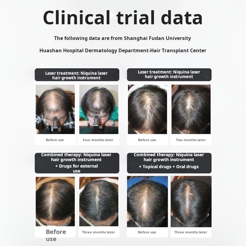 Les bonnets de croissance des cheveux laser Nutralla Nikina 120 sont équipés de casques de croissance des cheveux intelligents pour prévenir la chute des cheveux et la calvitie Hifu Alma