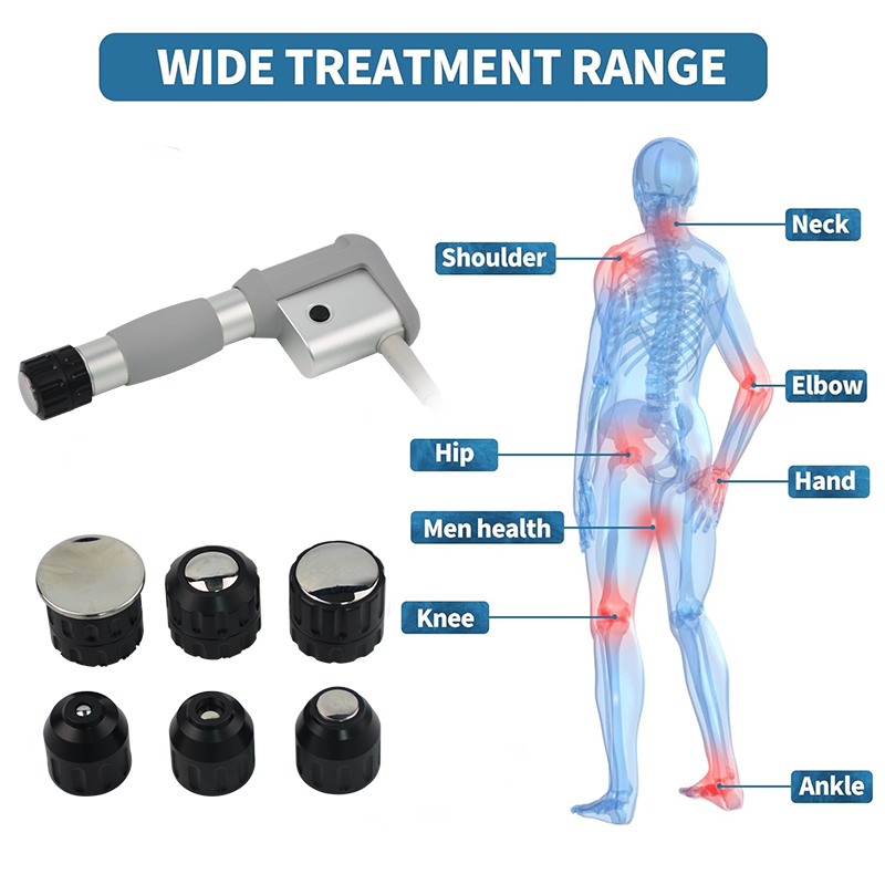 Nieuwe producten Extracorporeale schokgolven Medische apparatuur Pneumatische schokgolf Gainswave