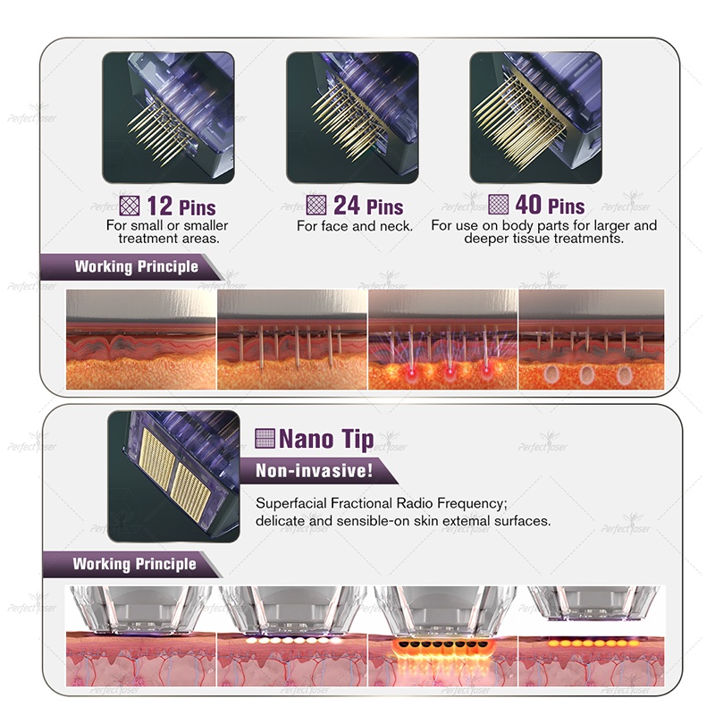 Microneedling fractionné RF Machine M8 Micro Needling Élimination des rides du visage Anti-âge Rajeunissement Lifting du visage Équipement de traitement des cicatrices d'acné