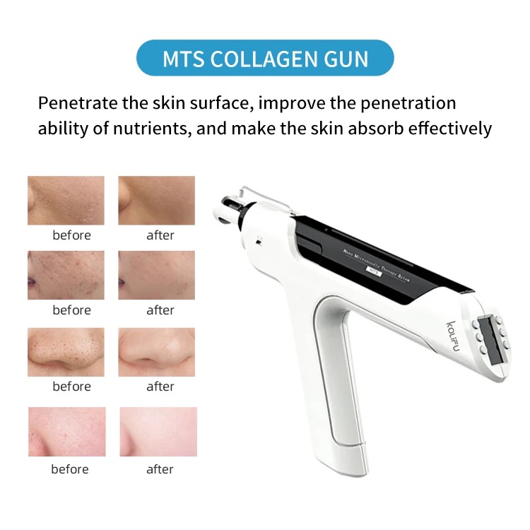 ナノマイクロニードル療法システムRF注入MTS Hydra Pen Meso Gun Face Skin Care Mesogun for Skin Rejuvenation Facial Lifting anti Aging