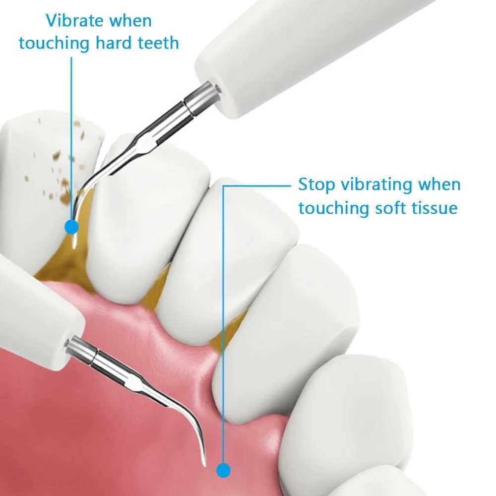Ирригаторы для полости рта Средство для удаления зубного камня для чистки зубов Татарское средство для удаления USB-аккумуляторный набор для чистки зубов с эндоскопом для полости рта для чистки зубов и ухода за полостью рта J240318