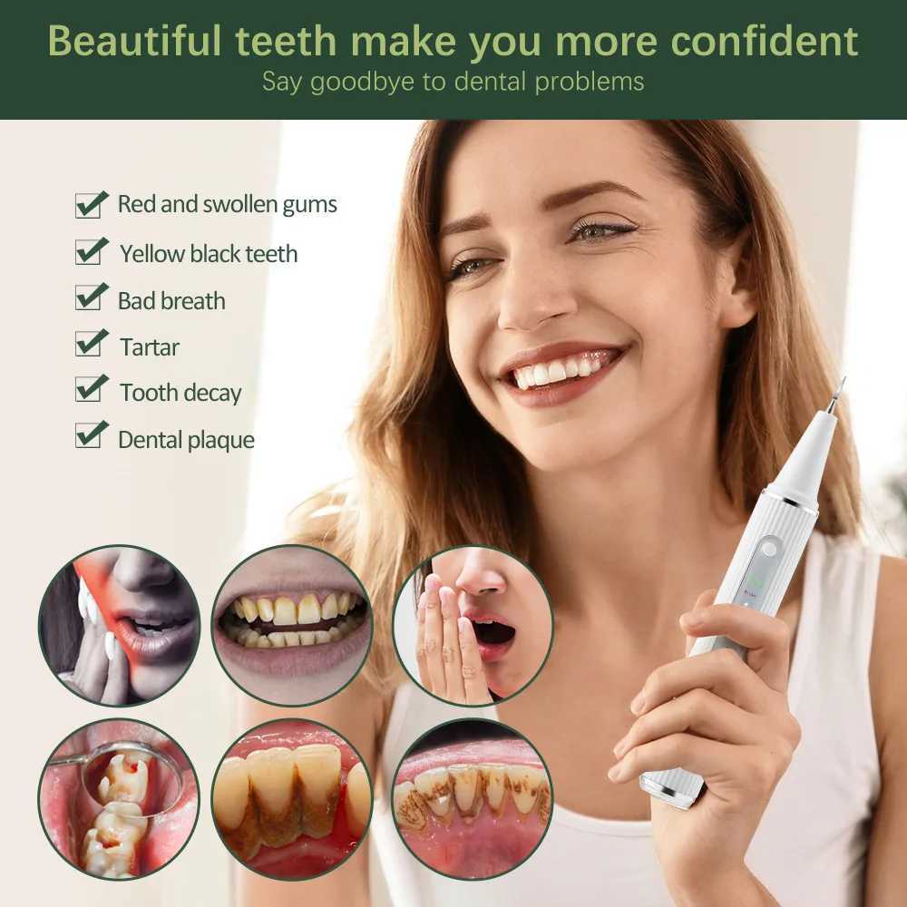 Oral Irrigatörler Görsel Dental Scaler Diş Beyazlatma ve Temizleme Hesap Plak Pigmentleri Çıkarma Tatar Sıyırıcı Ağız Hijyeni J240318'i önleyebilir