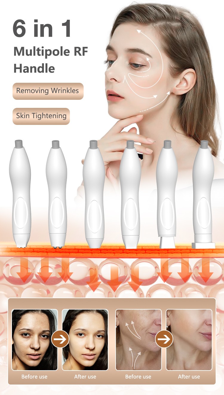 Bestförsäljande produkter Fraktionerad RF Wrinkle Remover Radio Frequency Skin Drawning Device RF Fraktionsmaskin för hudföryngring