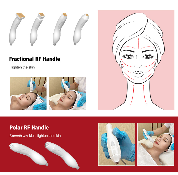 새로운 휴대용 스트레치 마크 제거 주름 제거 뷰티 바늘 바늘 RF 얼굴 리프팅 분수 방사성 퀘스트 분수 RF 미용 장비