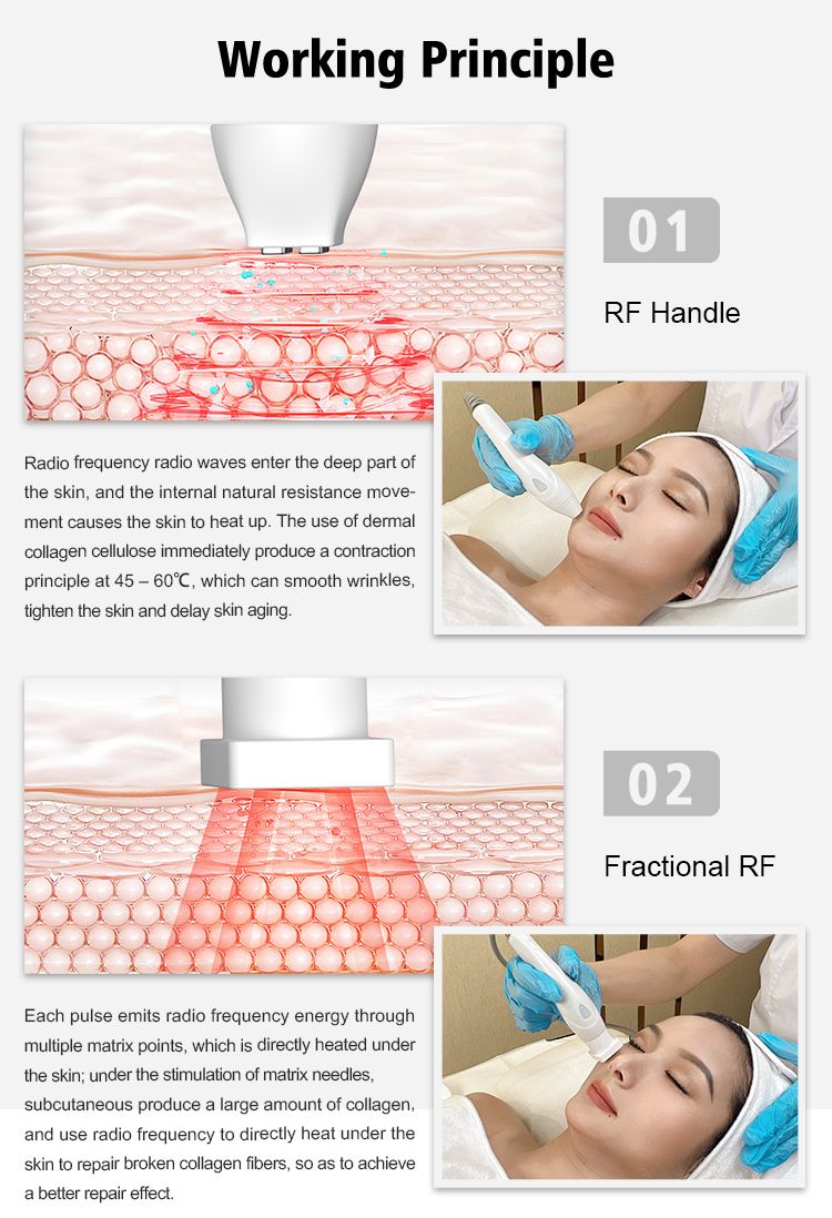 Anti Aging Beauty Machine RF Fraktionell hudförjustering EMS RF Facial Draw Direction