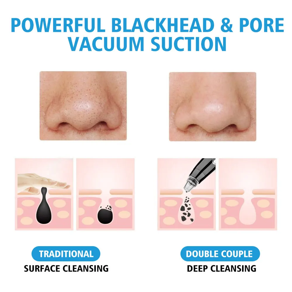 Accessories Blackhead Eliminator Vacuum Electric Nose Beauty Face Deep Cleansing Skin Care Vacuum Black Spots Acne Pore Cleaner Pimple Tool