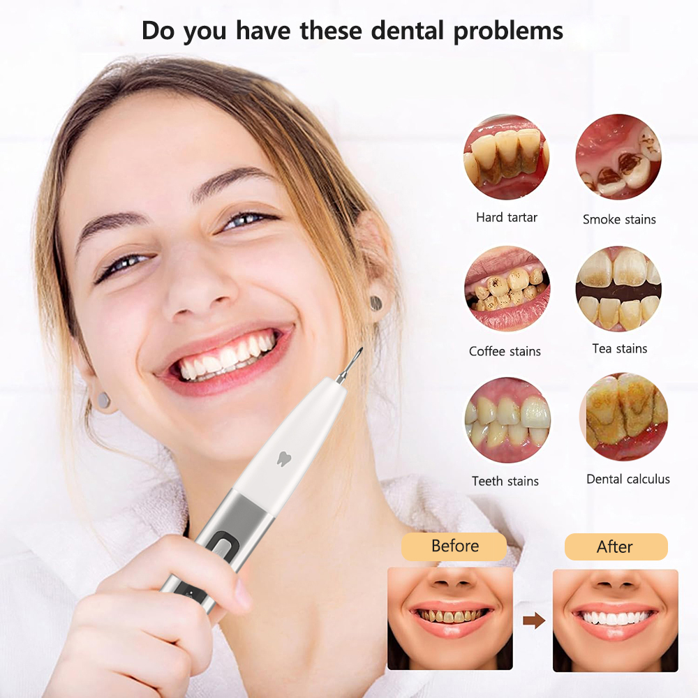 Ultrasonic Dental à l'échelle du nettoyage de dents Élimination de la plaque dentaire sonore Retrason en pierre dentaire pour les dents Calcul tartare