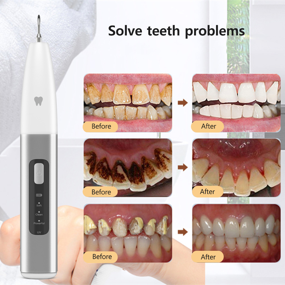 Ultrasonic Dental à l'échelle du nettoyage de dents Élimination de la plaque dentaire sonore Retrason en pierre dentaire pour les dents Calcul tartare