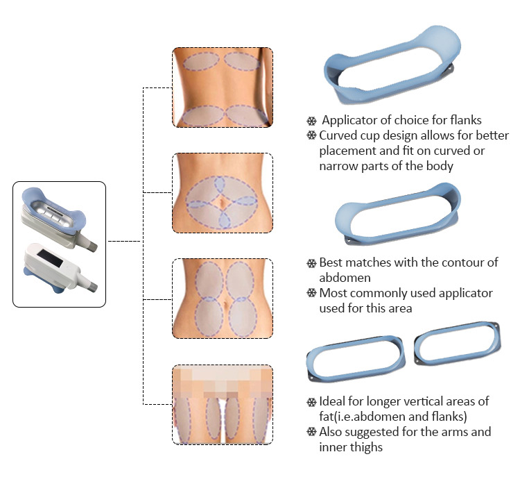 진공 체적 지방 제거 cryo 동결 슬리밍 머신 RF 신체 형성 얼굴 안티 주름 cryolipolyse 지방 감소 체중 감량 살롱 사용